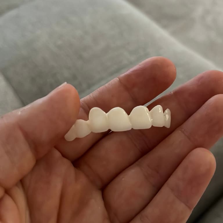 Elvankent Ağız ve Diş Sağlığı Dişim İki Kez Kırıldı 2 Kez Yapıştırıcısı Çıktı.