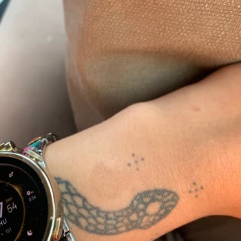 Huawei Gt3 Saat Deride Güneş Lekesi Şeklinde Leke Bırakıyor.