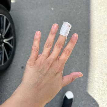 Rowenta Protect Saç Kurutma Makinesi Elimde Patladı!