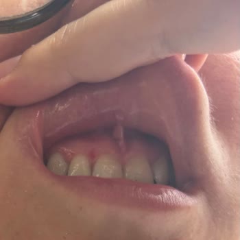 Darıca Ağız Ve Diş Sağlığı Merkezi Doktoru İşini Doğru Yapmanı Tavsiye Ederim