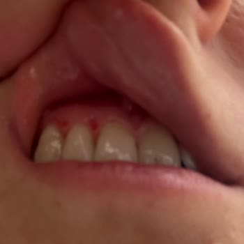 Darıca Ağız Ve Diş Sağlığı Merkezi Doktoru İşini Doğru Yapmanı Tavsiye Ederim