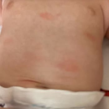 Mustela Bebek Şampuan Ve Nemlendirici Kızarıklık Yapıyor.