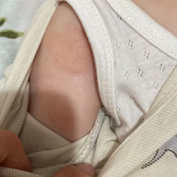 Mustela Bebek Şampuan Ve Nemlendirici Kızarıklık Yapıyor.