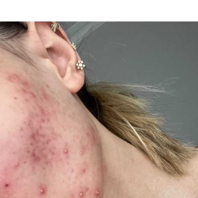 Moonqueen Kötü Cilt Bakım