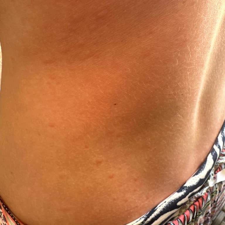 Eda Taşpınar Alerjik Reaksiyon Ve Beklenmeyen Etki!