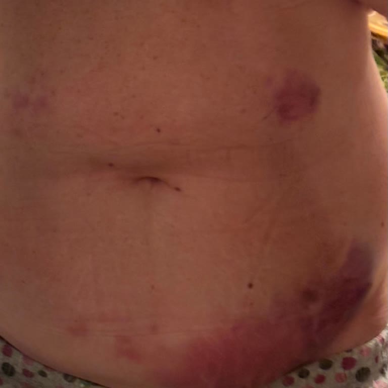 Miramiss Beauty Center Güzellik Merkezi Deneyiminde Yaşanan Sorunlar