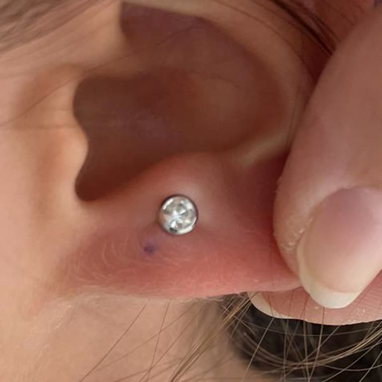 Kartal Özel Marmara Evde Bakım Ve Sağlık Hizmetleri Memnuniyetsizliği