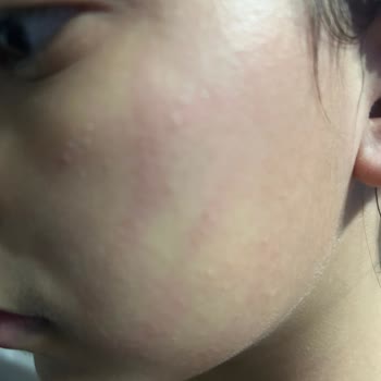 Sebamed Kepeğe Karşı Şampuan