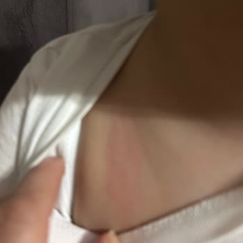 Sebamed Kepeğe Karşı Şampuan