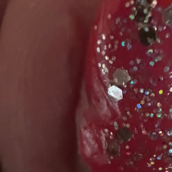 Sibel Öztürk Beauty Batık Tırnak Tedavi Edecekken Enfeksiyon Kaptım