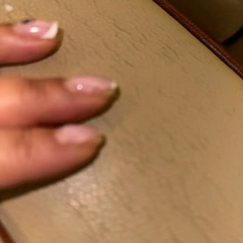 Sibel Öztürk Beauty Batık Tırnak Tedavi Edecekken Enfeksiyon Kaptım