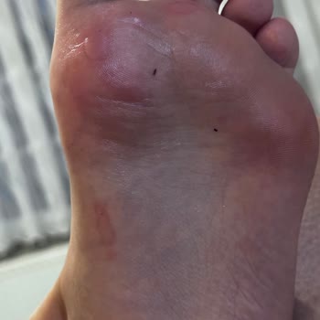 Derimod Mağazası Terlik Şikayet!