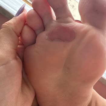 Derimod Mağazası Terlik Şikayet!