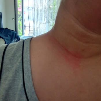 Trendyol Çelik Ürün Diye Sahte Ürün Gönderildi