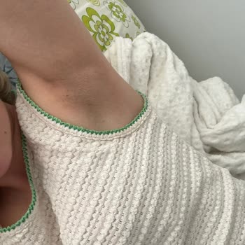 Nivea Black And White Koltuk Altı Kararması