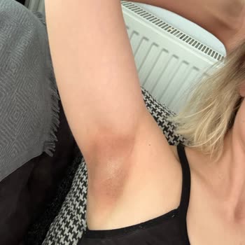 Nivea Black And White Koltuk Altı Kararması