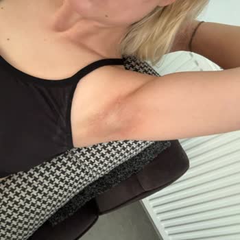 Nivea Black And White Koltuk Altı Kararması