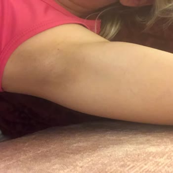 Nivea Black And White Koltuk Altı Kararması