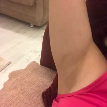 Nivea Black And White Koltuk Altı Kararması