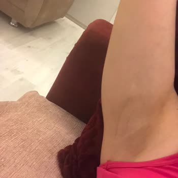 Nivea Black And White Koltuk Altı Kararması