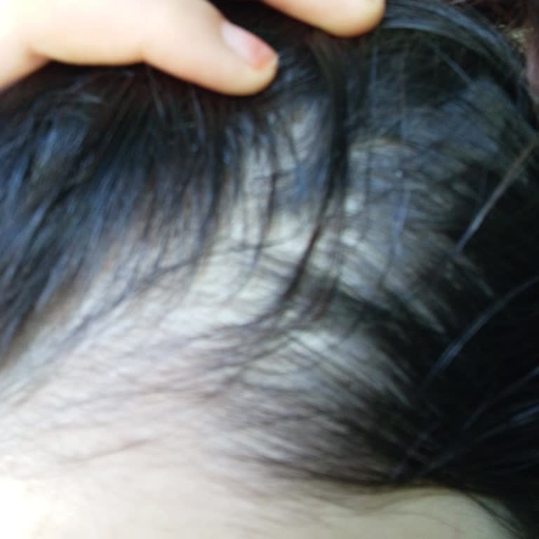 Bioblas Saç Dökülmesi Sarımsaklı Şampuan