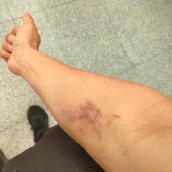 Çerkezköy Güven 1 Sağlık Sorunları