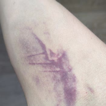 Çerkezköy Güven 1 Sağlık Sorunları