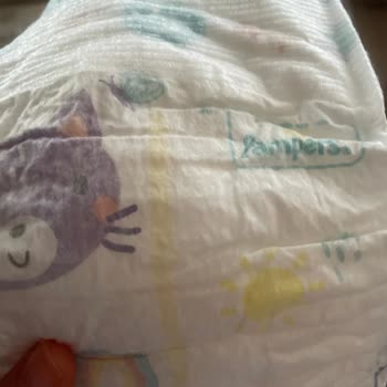 Подгузники Pampers вызвали раздражение кожи у ребенка