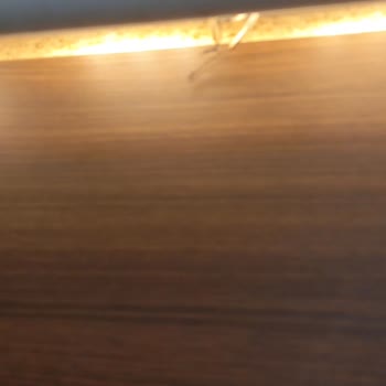 Burger King Ödeme Bankosunun Elektrik Kablosu Kızımın Elini Yaktı.