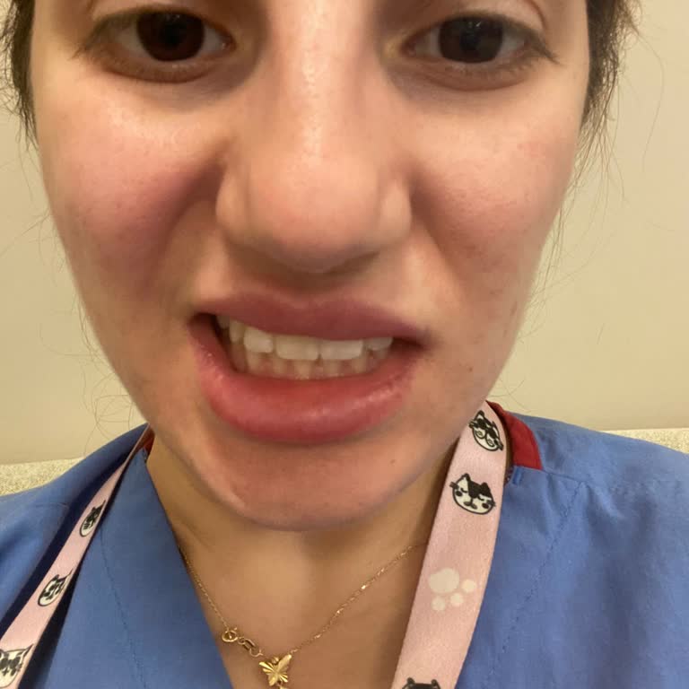 Estesante Clinic Estesante Beylikdüzü'nde Botoks Göz Kapağımı Düşürdü Yüzümü Kaydırdı