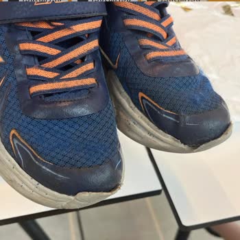Skechers Ürün Deformasyonu Ve Mağduriyeti