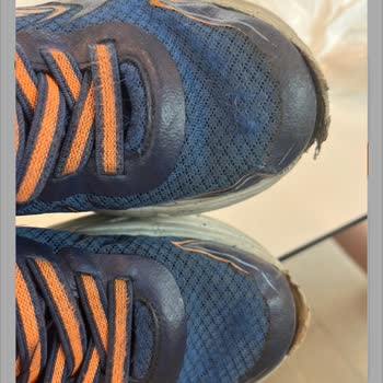 Skechers Ürün Deformasyonu Ve Mağduriyeti