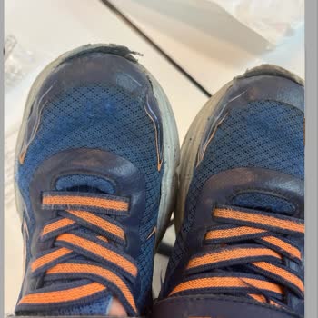 Skechers Ürün Deformasyonu Ve Mağduriyeti