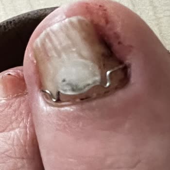 İzmir Ayak Bakımı İzmir Ayak Bakım Mağduriyeti