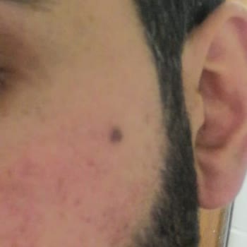 N-EST Estetik Kliniği Erzurum Ben Aldırma Sorunu