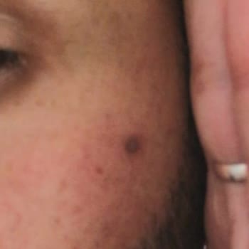 N-EST Estetik Kliniği Erzurum Ben Aldırma Sorunu