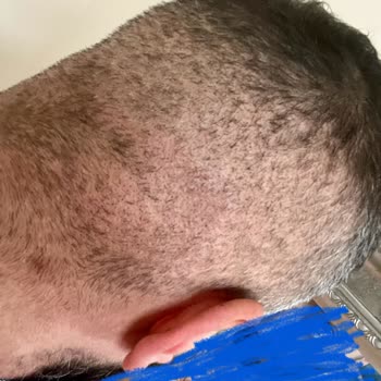 Ames Health Beni Mağdur Etti