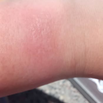 Huawei Saati Kolumu Yaktı