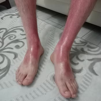 Vitamindolabi.com Adresinde Aldığım Sebamed Güneş Losyonu İçin Şikayet