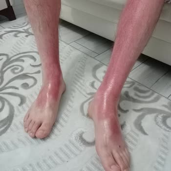 Vitamindolabi.com Adresinde Aldığım Sebamed Güneş Losyonu İçin Şikayet