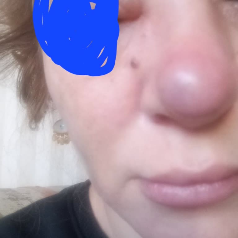 Hedonya Clinic Haksız Kazanç İnsan Sağlığa İle Oynama