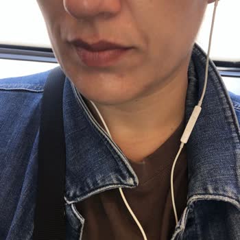 Venom Güzellik Salonu Uygulaması Sonrası Kalıcı Cilt Lekesi