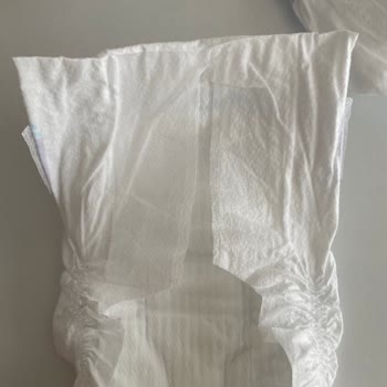 Molfix Bebek Bezinde Üretim Hatası