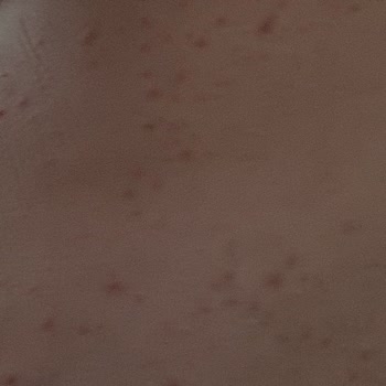 Veet Tüy Dokucu Vücudumu Mahvetti