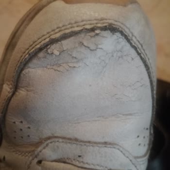 Adidas Ayakkabının Her Yeri Patladı