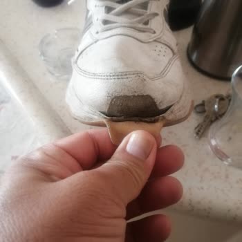 Adidas Ayakkabının Her Yeri Patladı