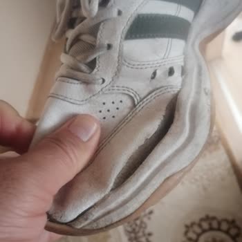 Adidas Ayakkabının Her Yeri Patladı