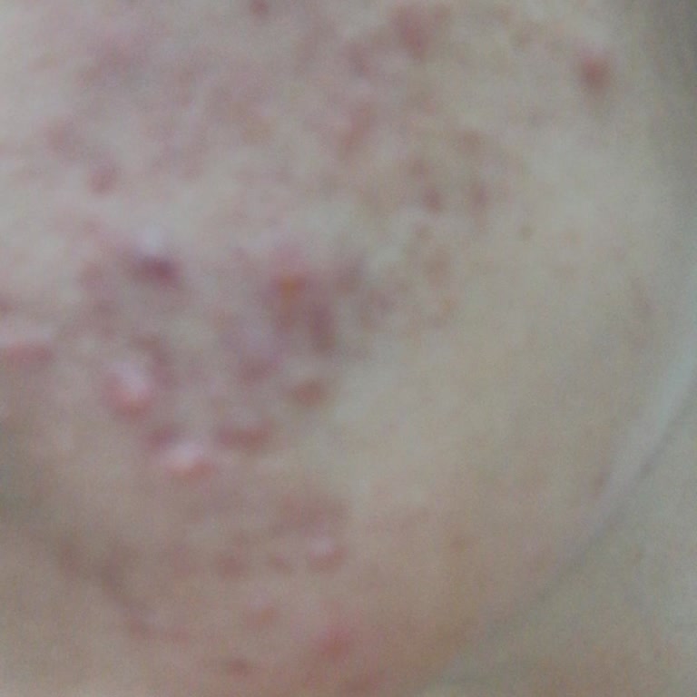 Bioderma Mahf Ettin Beni