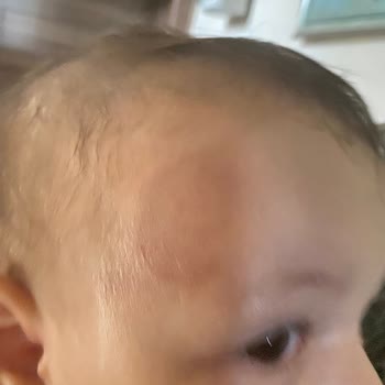 Trendyol Fırsat Baby Mama Sandalyesi Kırılması