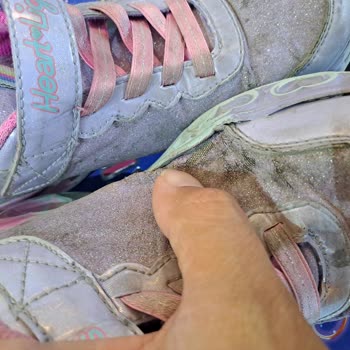 SuperStep Firmasından Aldığım Sketchers Ayakkabı Açılma Ve Yıpranma